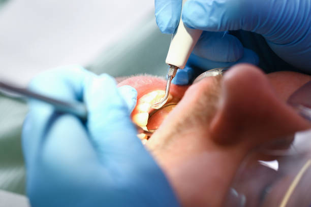 Professional Emergency Dentist in SC