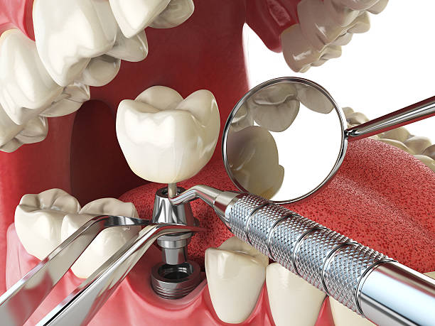 Best After-Hours Emergency Dentist in Brookdale, SC